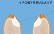イネの種子を開いたようす